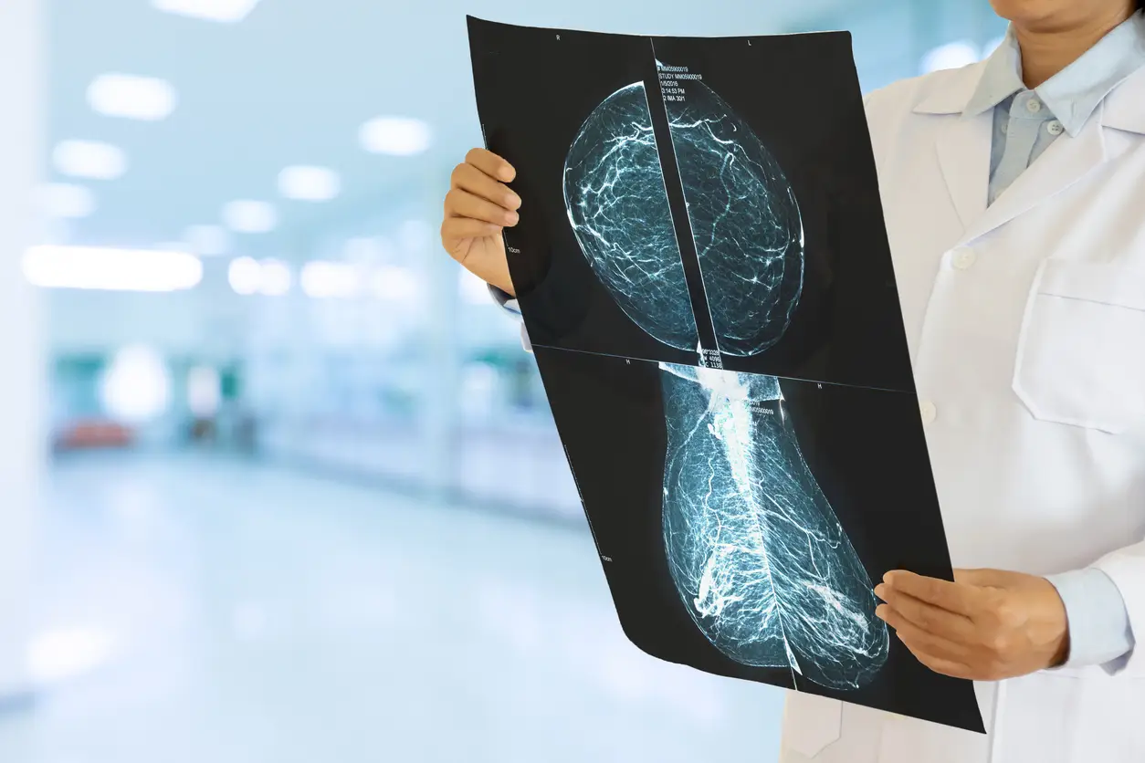 Why All Women Should Get an MRI for Breast Cancer Screening